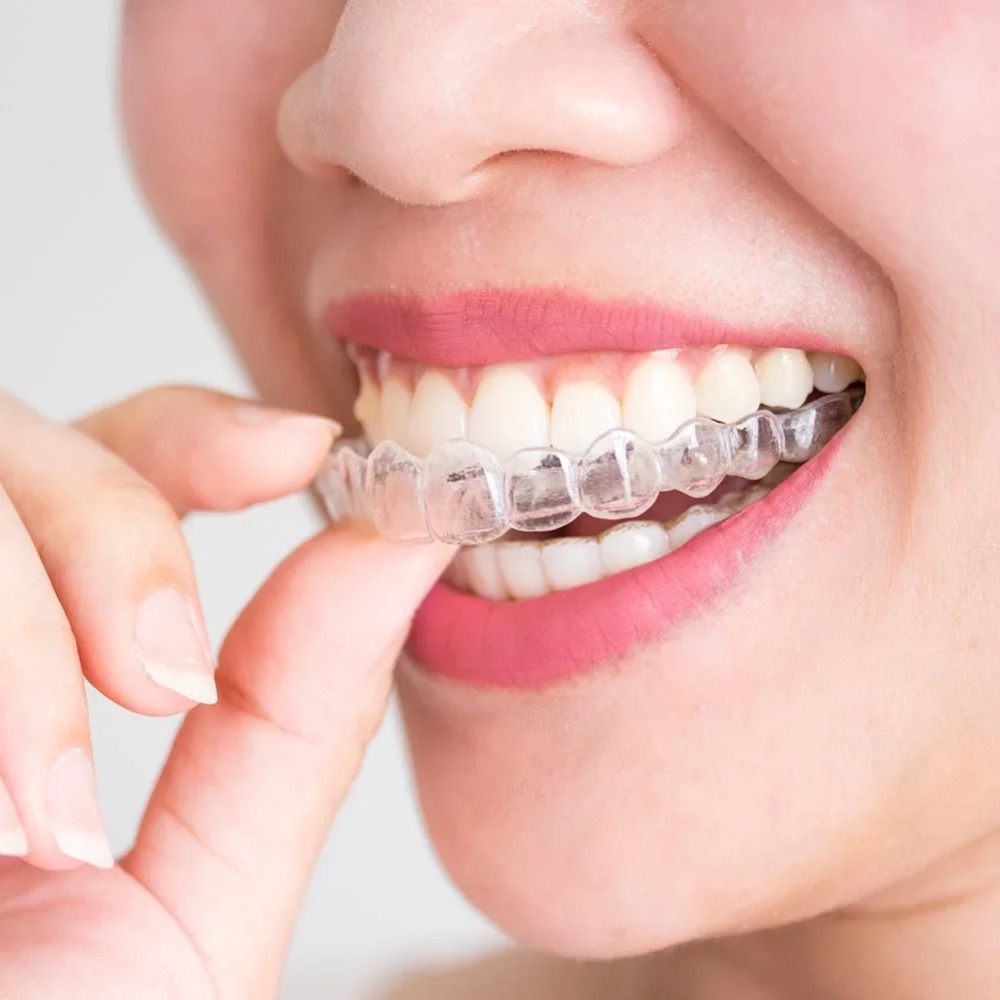 Dental Guard Night - Protetor Bucal Noturno Anti Ronco e