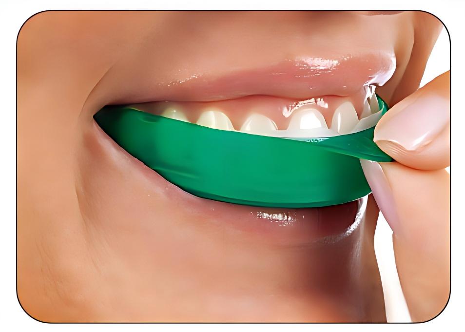 Teeth Whitening Opalescence Go - Ultradent Opalescence Go Tiras Clareadoras de