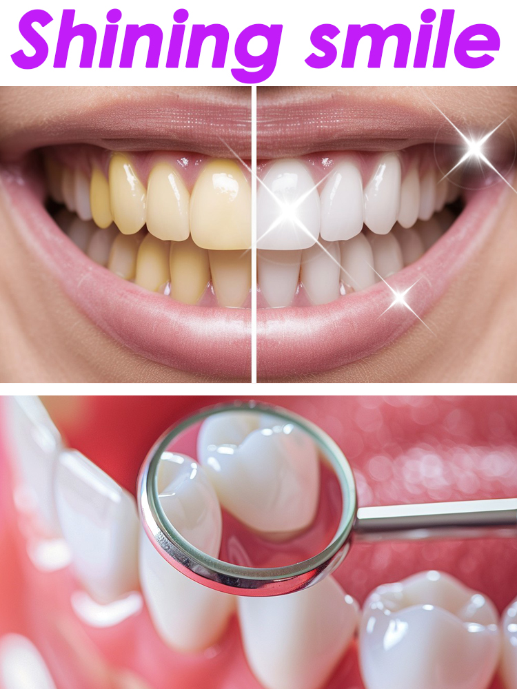 Teeth Whitening Xylitol - Glorysmile produtos de pasta de dente