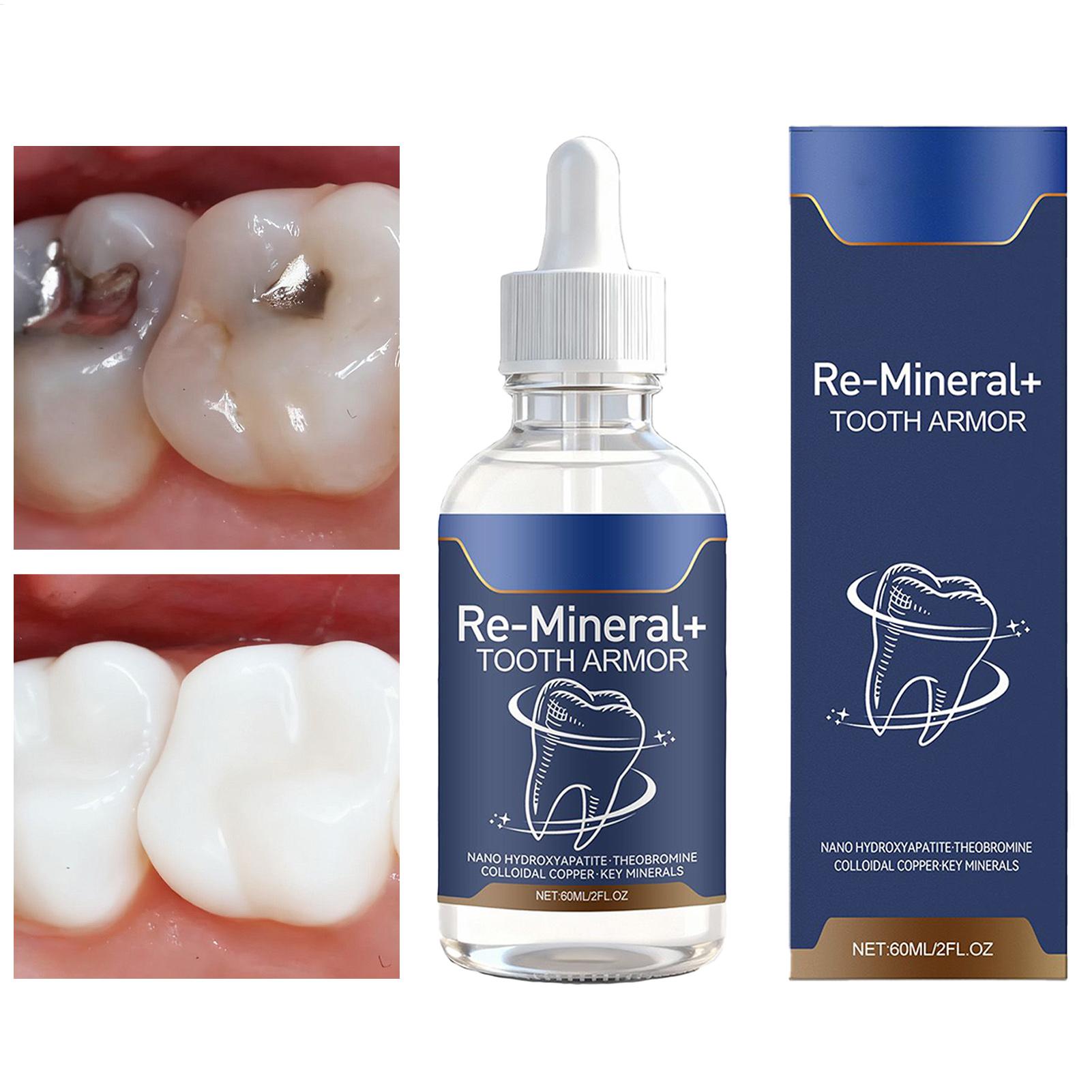 Teeth Whitening And Stain Removal - Líquido de Limpeza Dental 60ml Remove