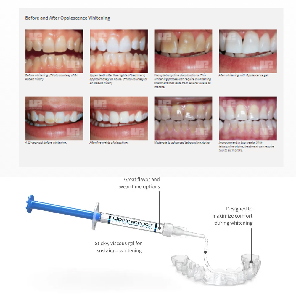 Opalescência Whitening Gel Kit - Teeth Whitening Bleaching Kit avaliação e preço