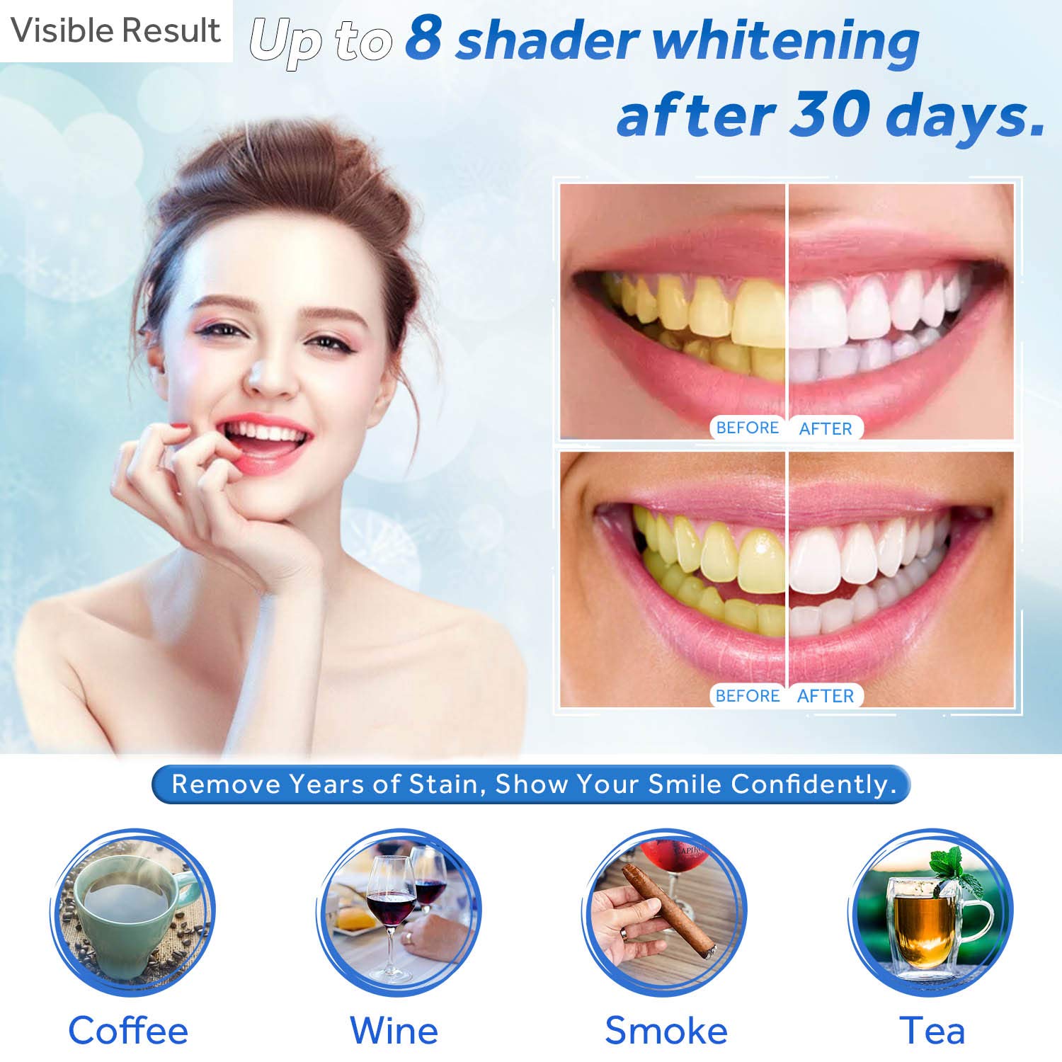 Seringa de recarga de gel para - Teeth Whitening Bleaching Kit avaliação e preço
