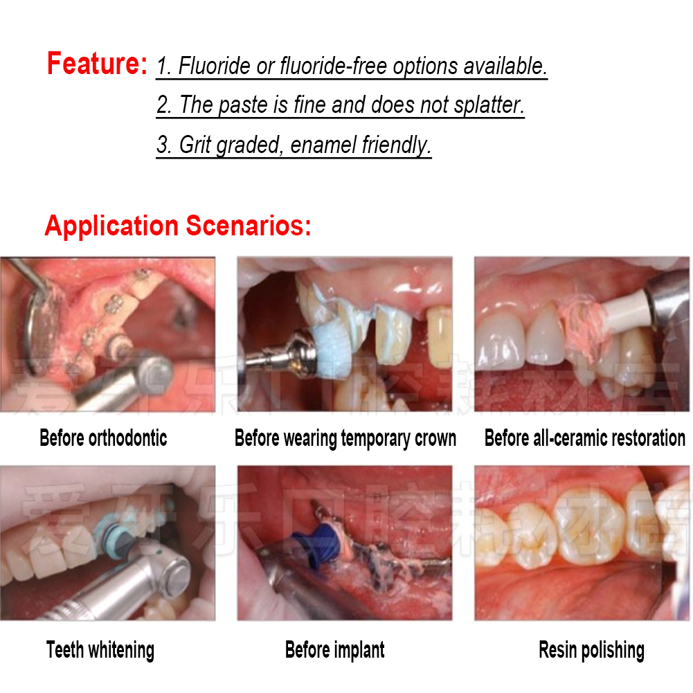 Ivoclar Vivadent Pasta Polidor - Teeth Whitening Xylitol avaliação e preço