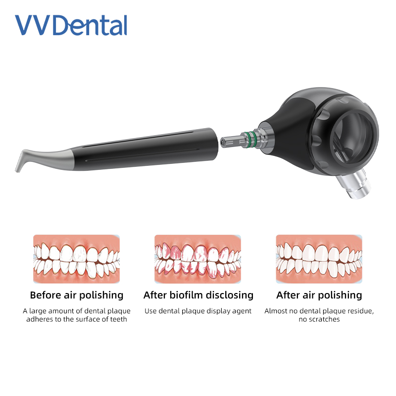 Vvdental polidor de ar jet air - Colgate Whitening Teeth avaliação e preço