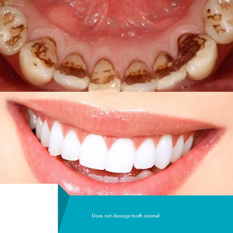 Pó erval do dente, pó natural  - Teeth Whitening Xylitol avaliação e preço