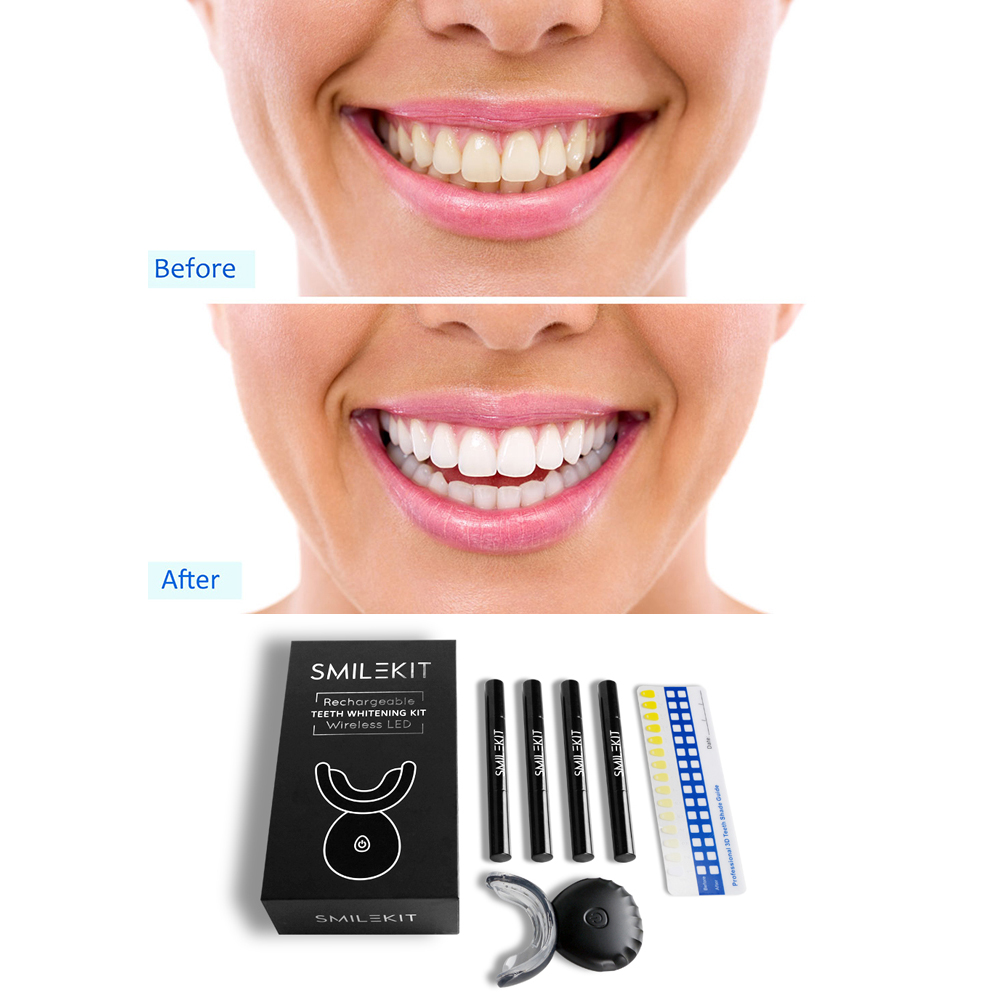 Nova elétrica dentes branqueam - Teeth Whitening Bleaching Kit avaliação e preço