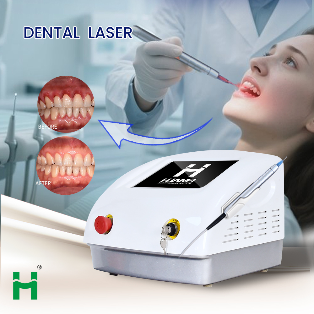 Kit Portátil de Clareamento De - Teeth Whitening Bleaching Kit avaliação e preço