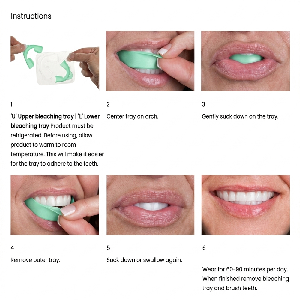 Trays de Clareamento Dental Pr - Teeth Whitening Opalescence Go avaliação e preço